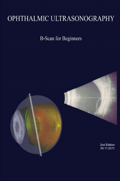 Ophthalmic Ultrasonography: B-Scan for Beginners
